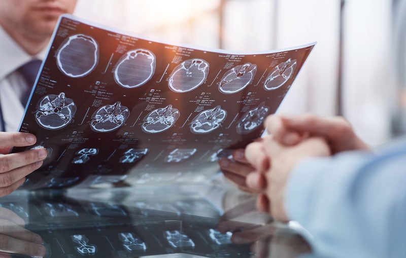 A person in a suit holding and reviewing a medical MRI scan of a brain.