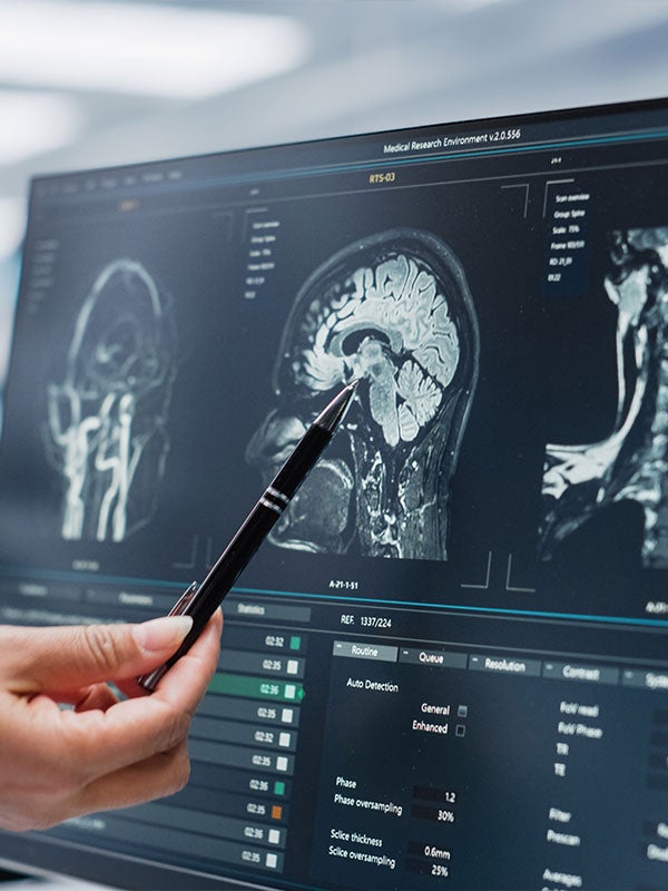Someone's hand pointing with a pen at a computer screen showing a brain MRI scan and medical data.